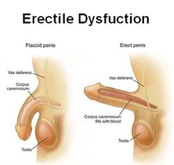 Treatment for low testosterone levels