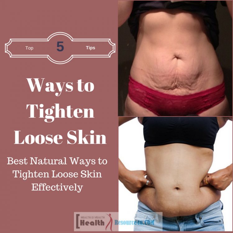Best Natural Ways to Tighten Loose Skin Effectively