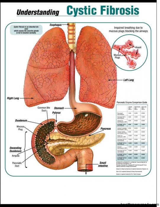 Cystic Fibrosis Symptoms