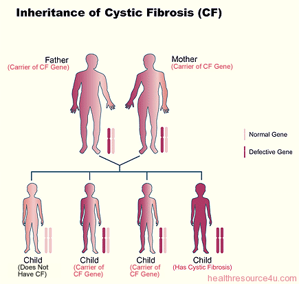 Cystic fibrosis inheritance