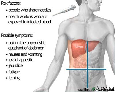 symptoms of Hepatitis
