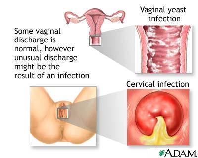 vaginal itching pictures