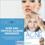 Acne and Critical Illness Insurance