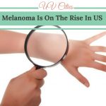 Melanoma Is On The Rise In US