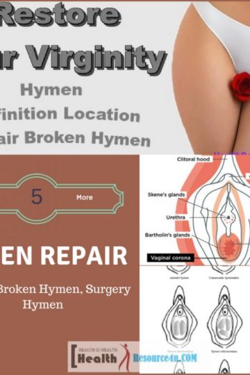 Repair Broken Hymen, Surgery Hymen
