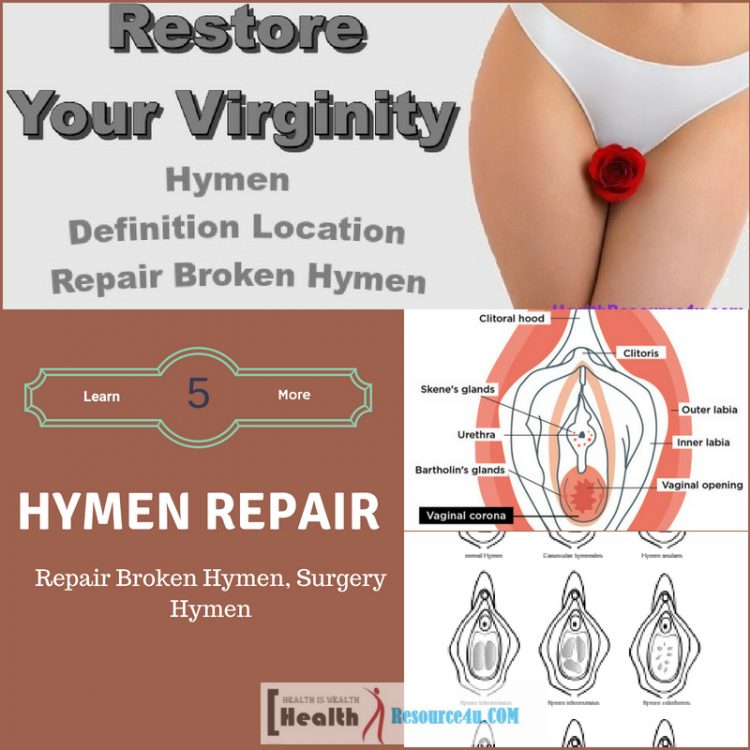 Repair Broken Hymen, Surgery Hymen