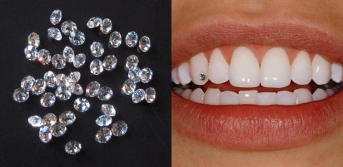 Tooth Jewelry Procedure