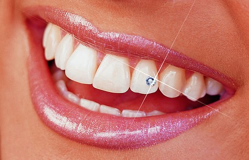 Tooth Jewelry and Dentistry