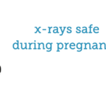 X-Rays During Pregnancy