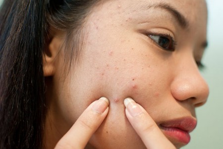 Causes of Bad skin