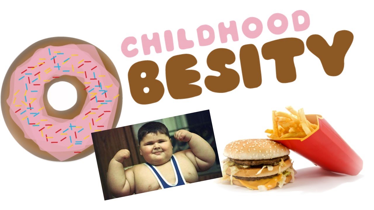 Obesity in Children