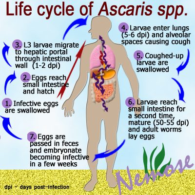 Ascariasis