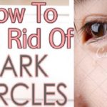Get Rid Of Dark Circles Under Your Eyes