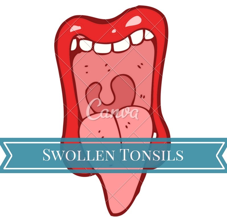Swollen Tonsils cause and treatment
