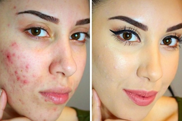 using-jojoba-oil-before-and-after-skin