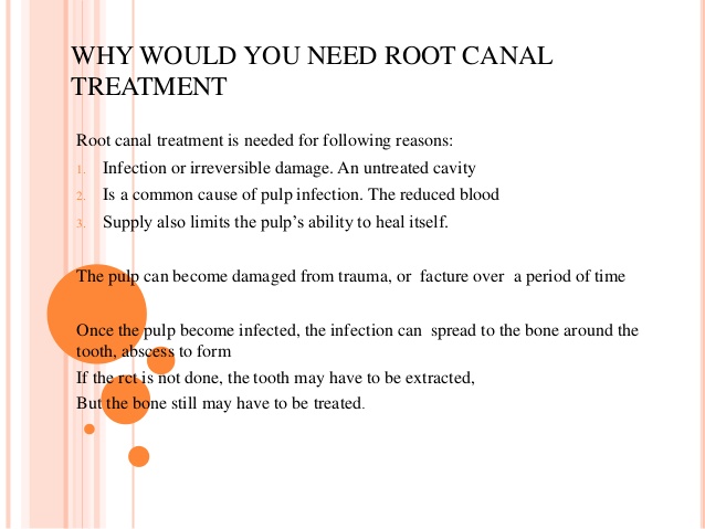 why you should take root canal treatment