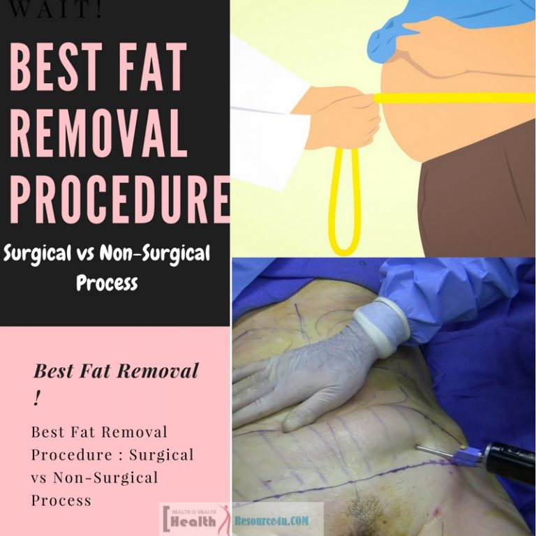 Best Fat Removal Procedure