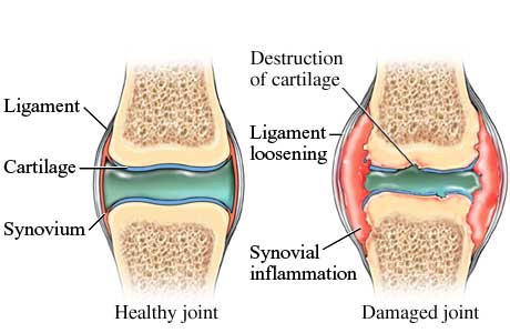 Foods for Healthy Joints