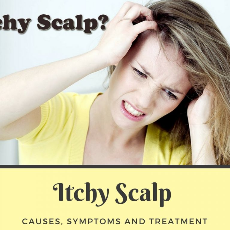Itchy Scalp – Causes, Symptoms And Treatment