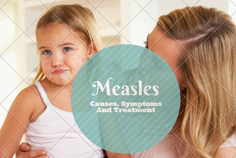 Measles Rash Causes, Symptoms And Treatment