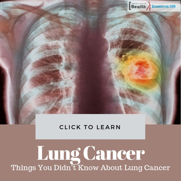 Things You Didn’t Know About Lung Cancer