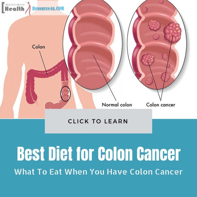 Best Diet for Colon Cancer