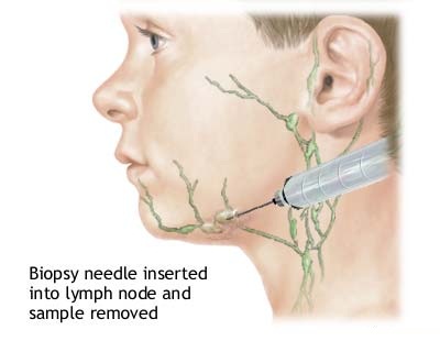 Lymph-Node-Locations-2