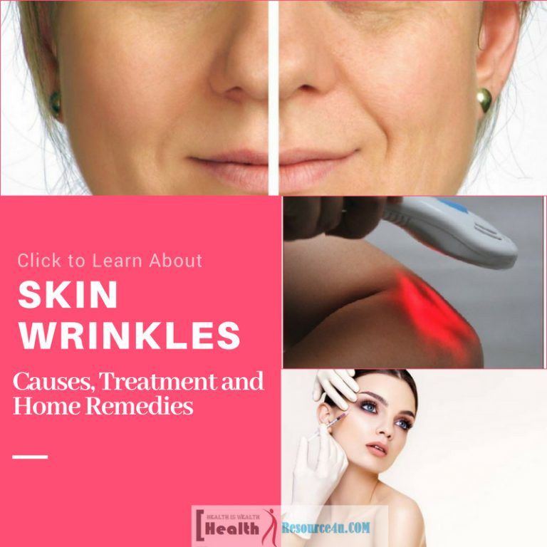 Skin Wrinkles Causes Treatment 1