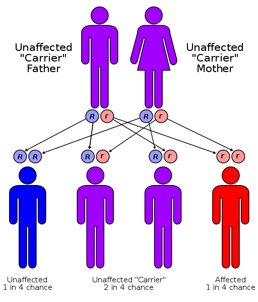 Wilson's disease