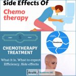 Chemotherapy Treatment