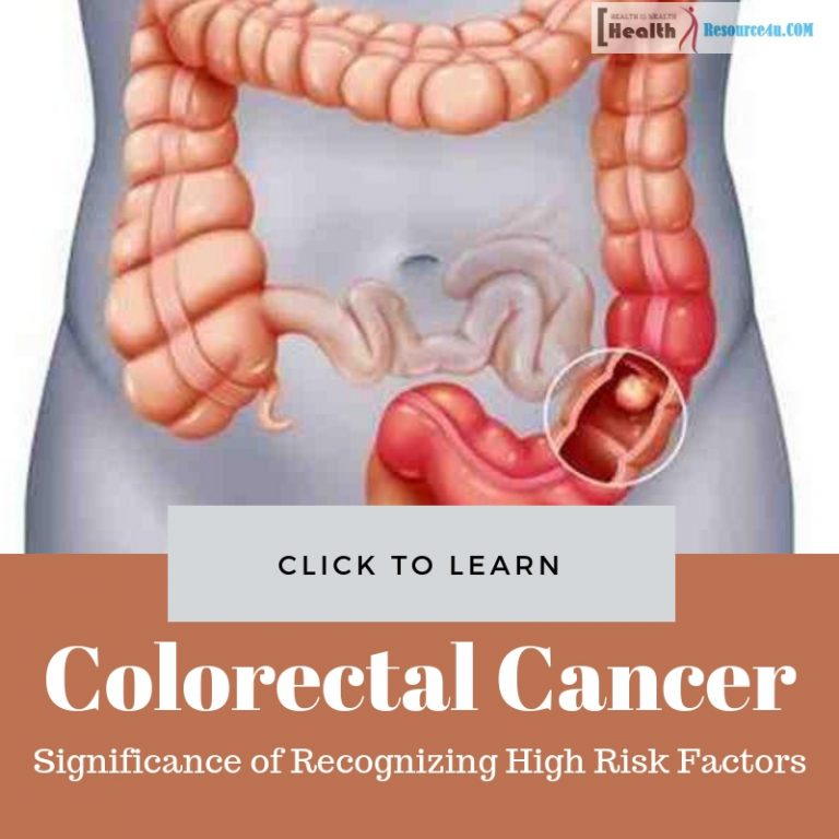 Colorectal Cancer