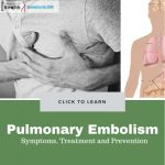 Pulmonary Embolism