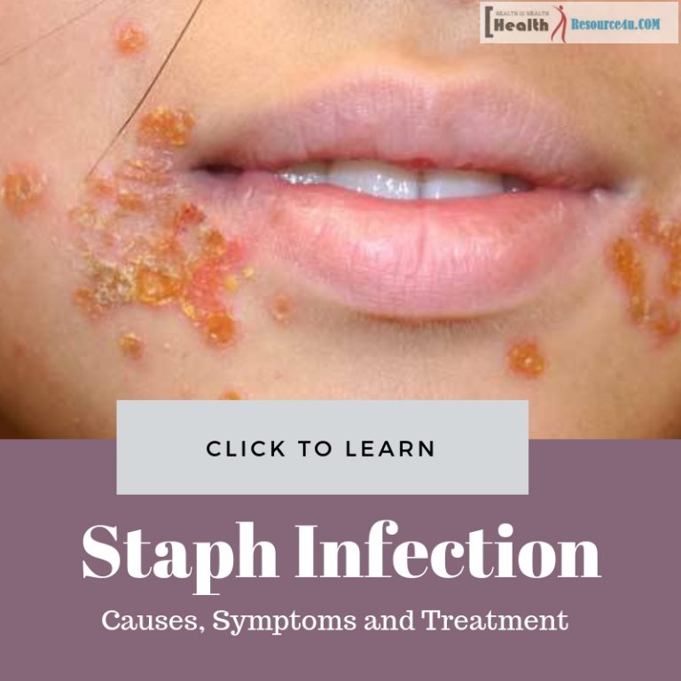 Staph Infection