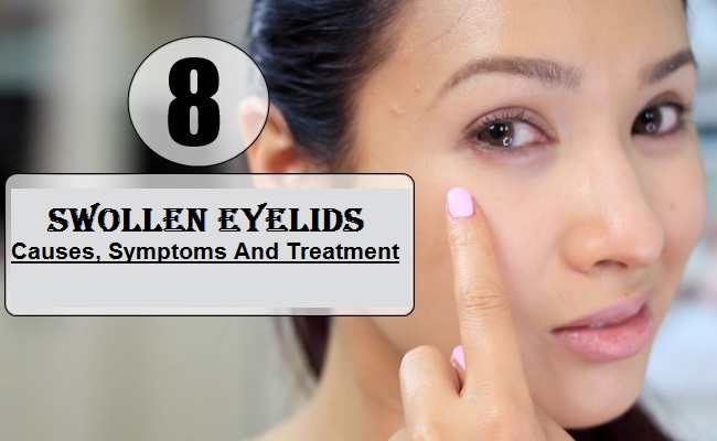 swollen eyelids Causes, Pictures, Symptoms And Treatment