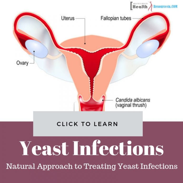 natural approach to treat yeast infection