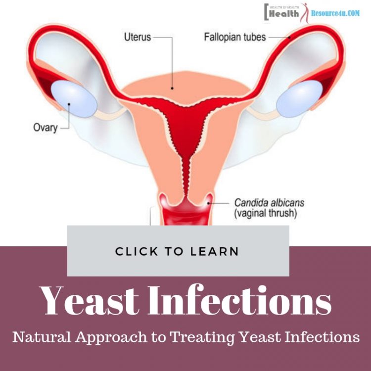 natural approach to treat yeast infection