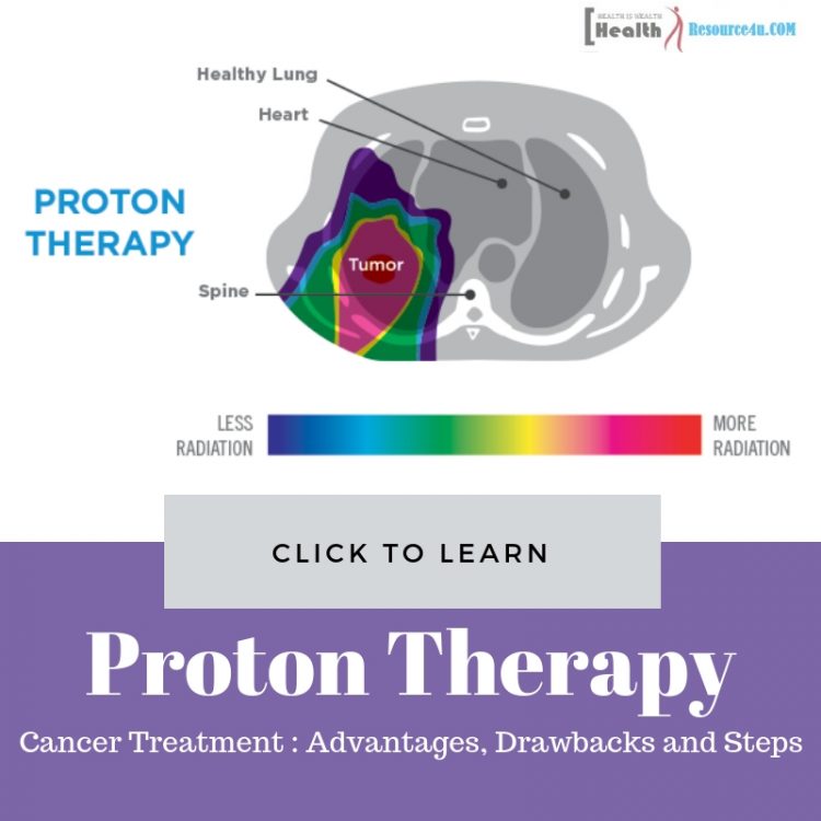 Proton Therapy for Cancer Treatment