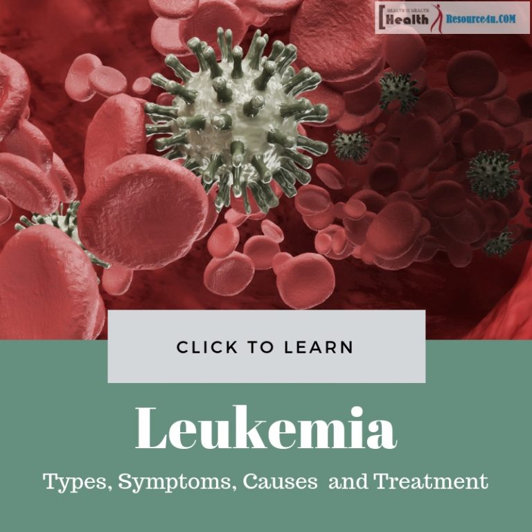 Leukemia Causes Treatment