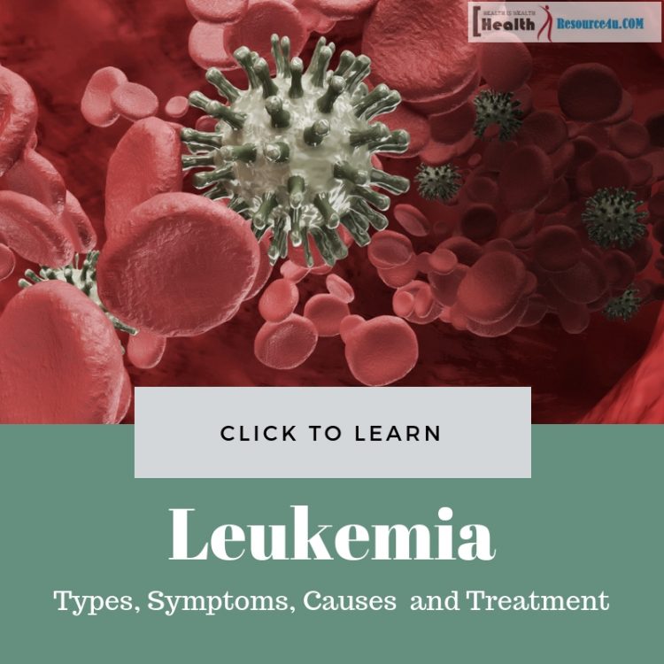 Leukemia Causes Treatment e1554523018146
