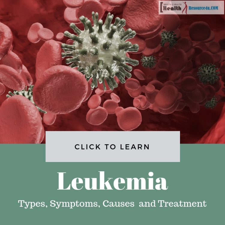 Leukemia Types Symptoms Causes Diagnosis And Treatment