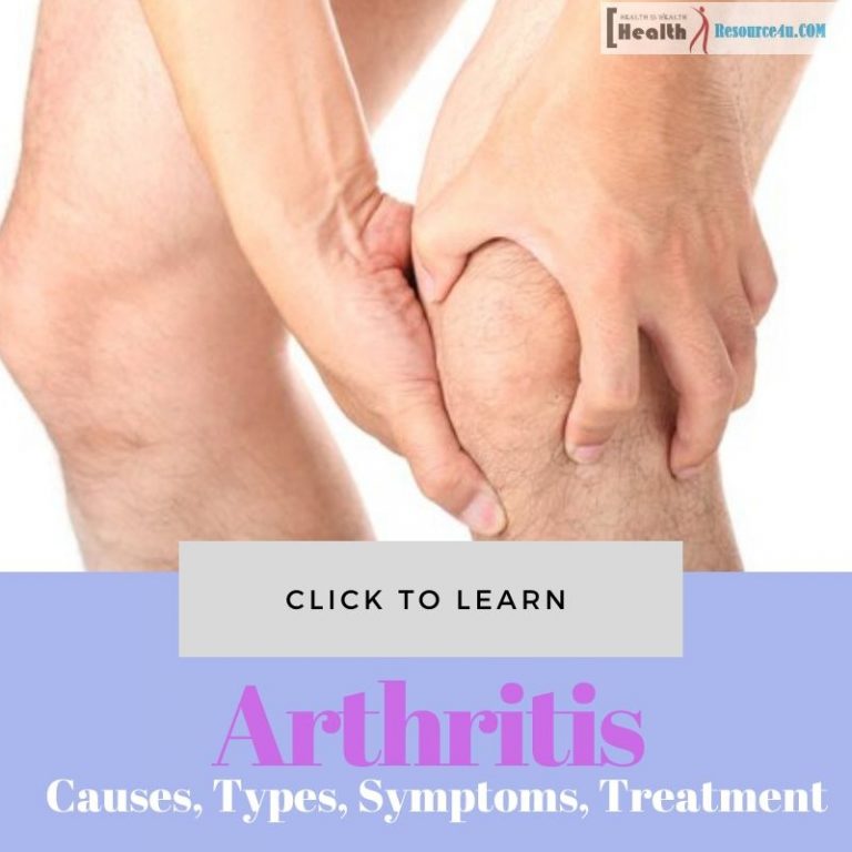Arthritis