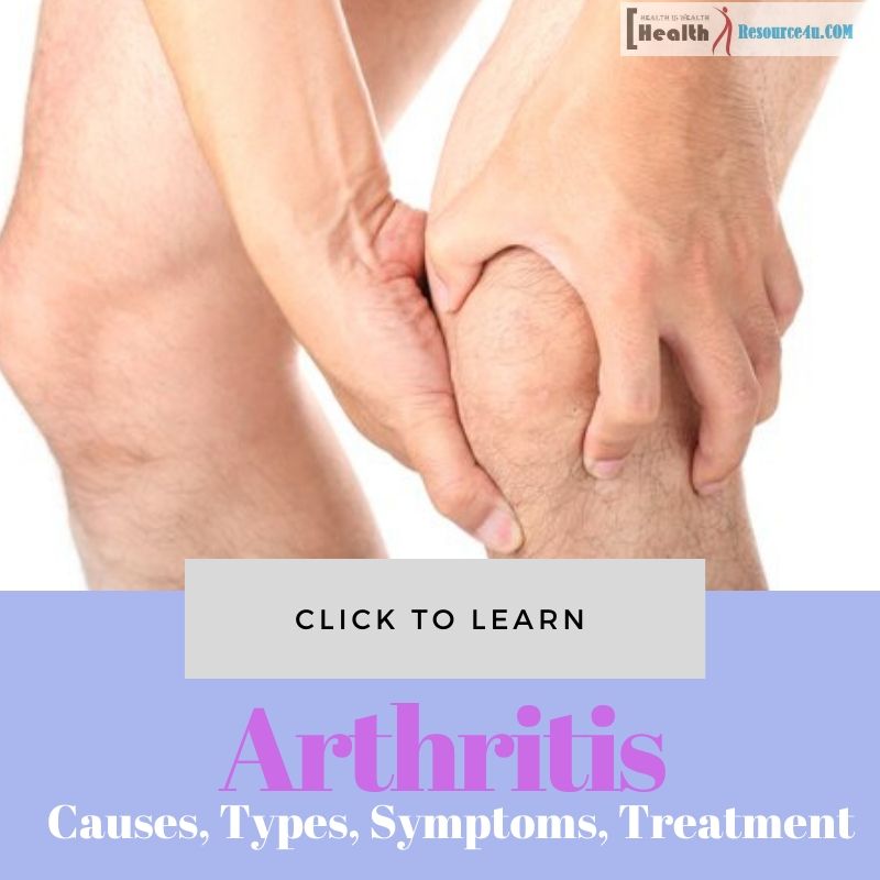 Arthritis