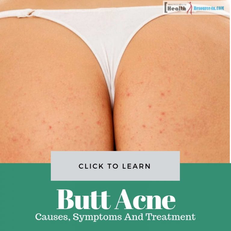Home Remedies For Butt Acne
