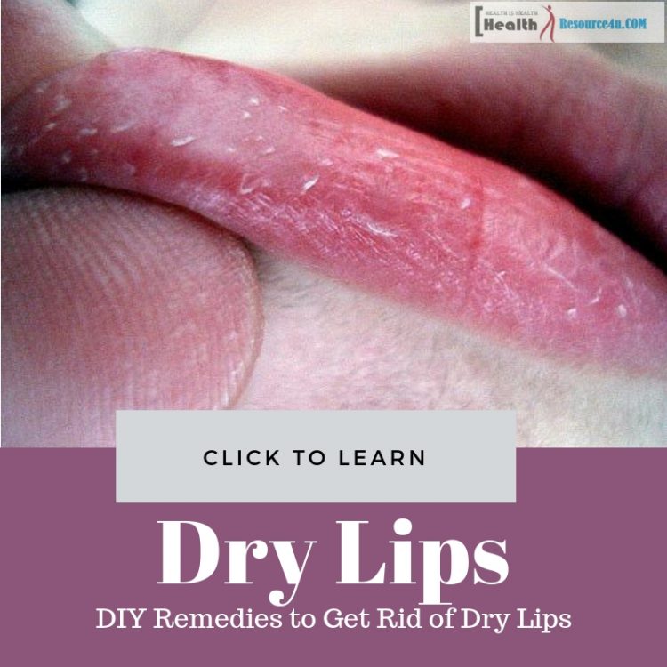 Remedies to Get Rid of Dry Lips