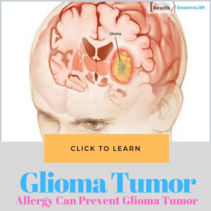 Allergy Can Prevent Glioma Tumor