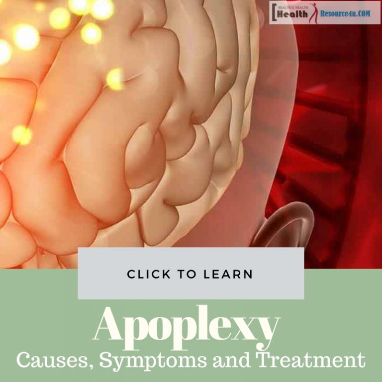 Apoplexy Causes Treatment