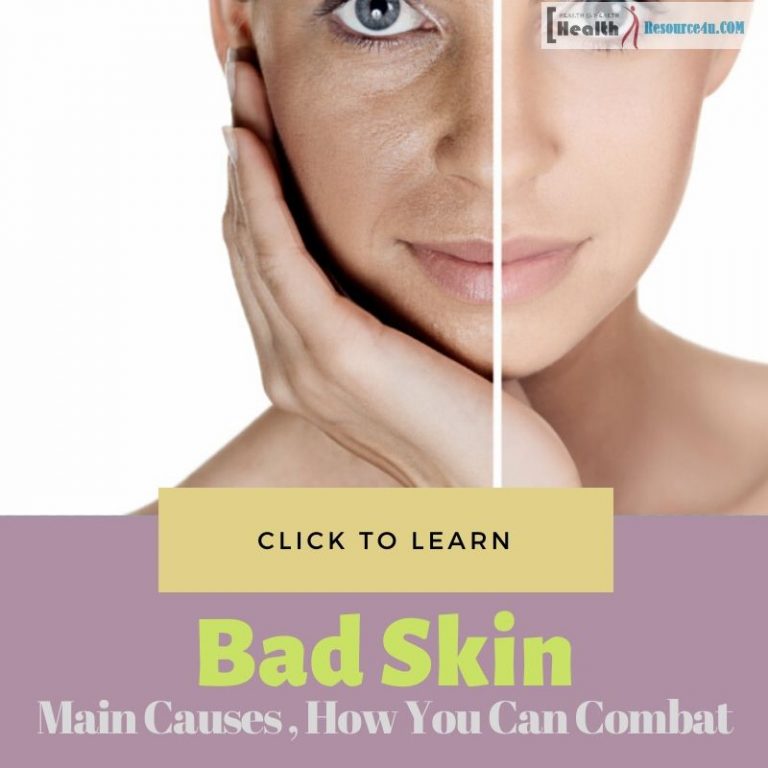 Bad Skin Causes