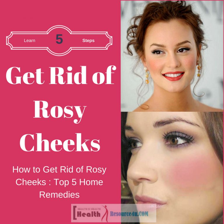 Get Rid of Rosy Cheeks