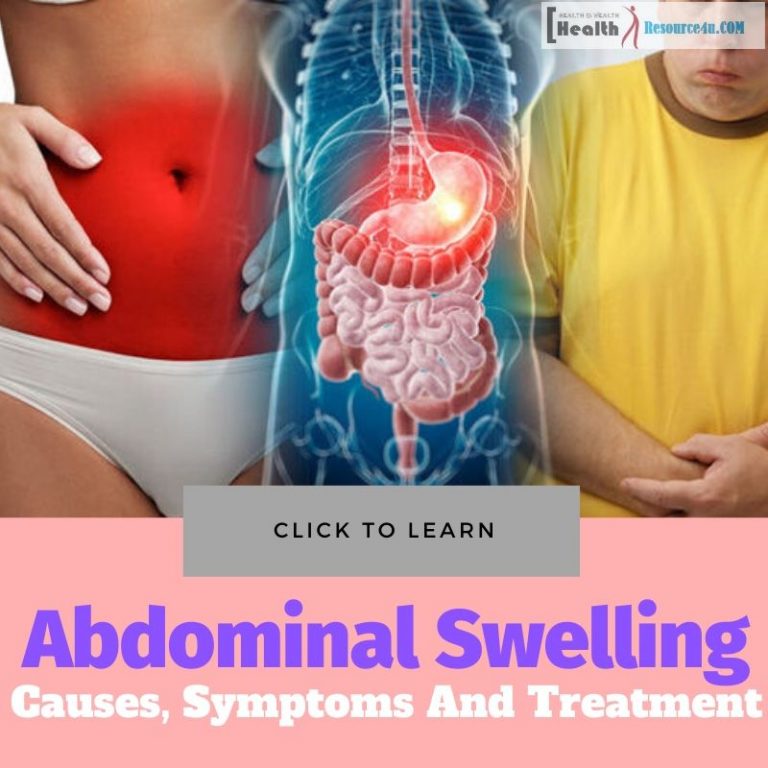 Abdominal Swelling