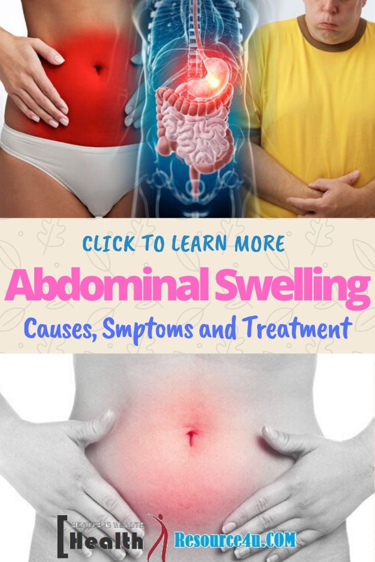 Abdominal Swelling Causes Treatment